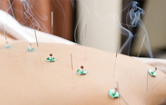 鍼灸